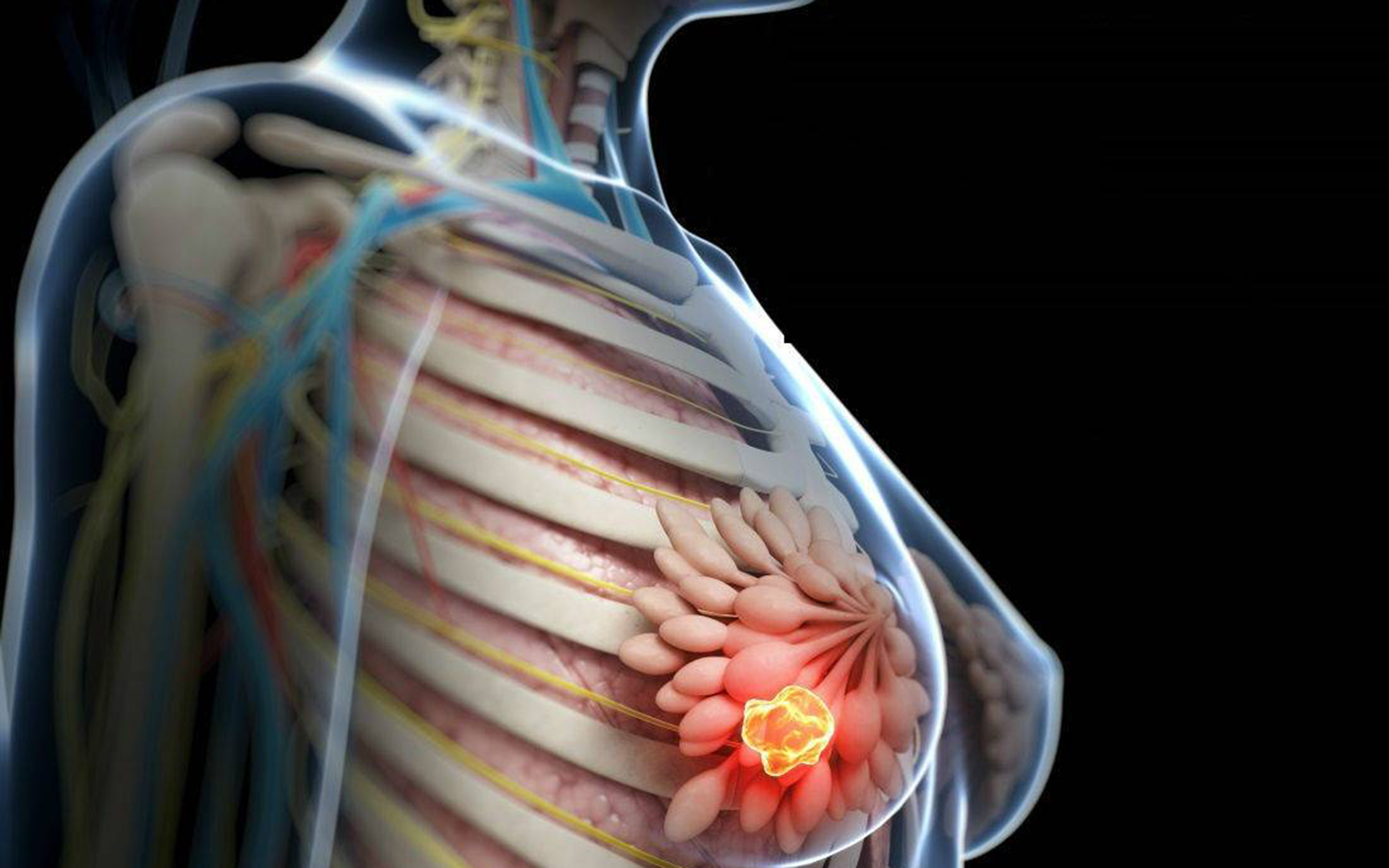 причины онкологии груди у женщин фото 65